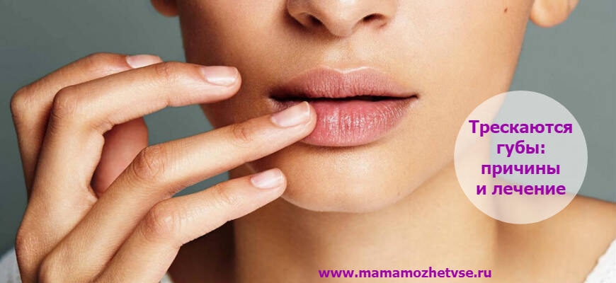 13 причин почему трескаются губы