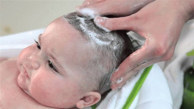 у новорожденного ребенка выпадают волосы