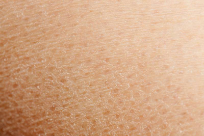причины по которым очень сухая кожа тела